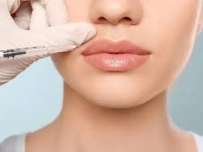 Lip Filler treatment in Dermyzz Skin Clinic in Andheri Mumbai